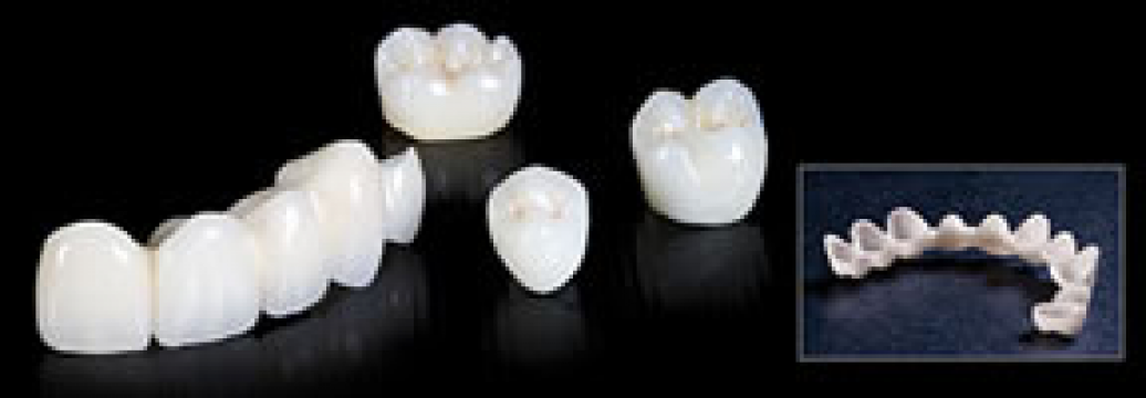 Coroane zirconiu dentare
