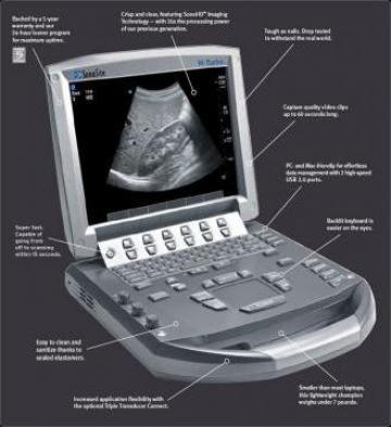 Ecograf Doppler color Sonosite M-turbo