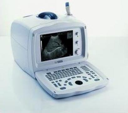 Ecografie abdominala, san