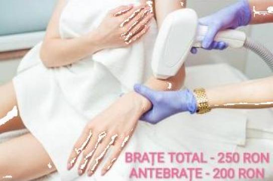 Epilare laser brate - Militari Residence