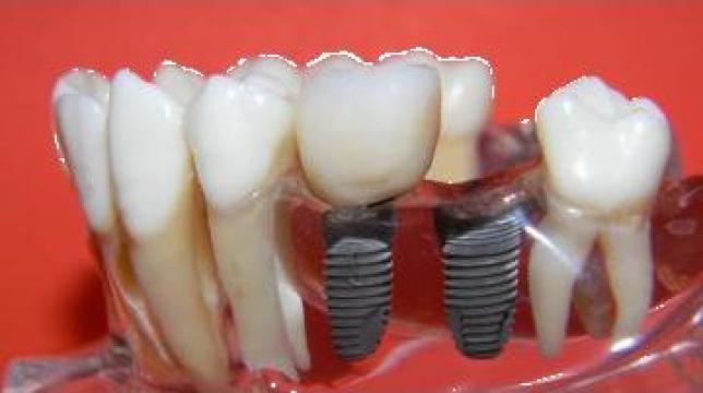 Implant dentar din titan