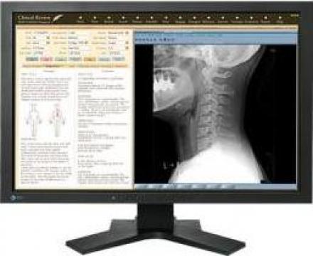 Monitor Eizo - MX240W LCD 2.3MP 61cm (24.1 inches)