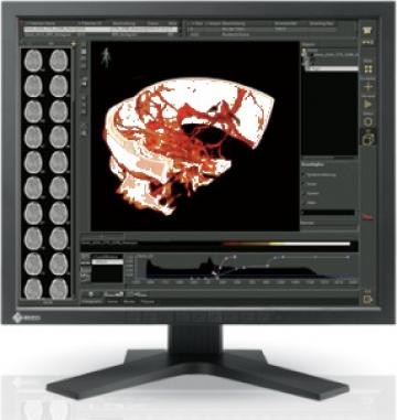 Monitor Eizo - RS110 Color LCD 1MP 48cm (19.3 inches)