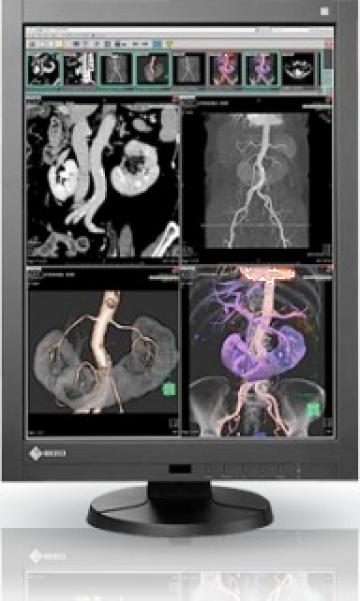 Monitor Eizo - RX340 Color LCD 3MP 54cm (21.2 inches)