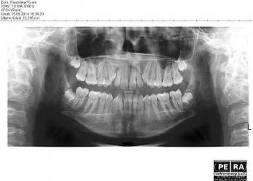 Radiografie panoramica (OPG) digitala