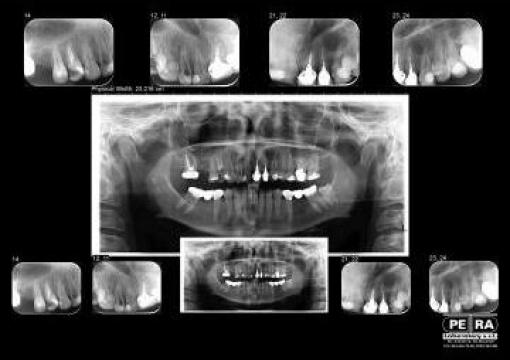 Radiografii OPG + I.O. digitale pe acelasi film
