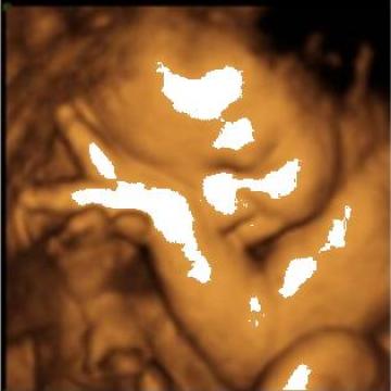 Servicii de obstetrica - ginecologie