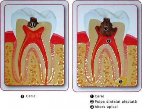 Servicii medicale stomatologie