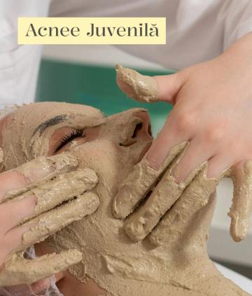 Tratament cosmetic 100% natural pentru acnee juvenila
