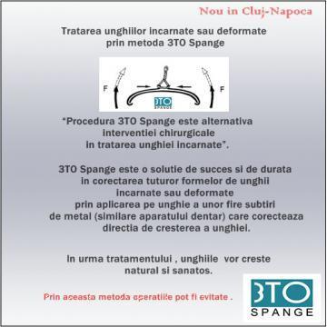 Tratament unghii deformate 3TO Spange